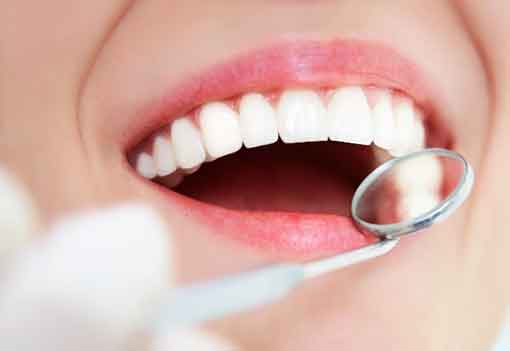 Cosmetic Dentistry | Havelock | Dr. Vipin Grover