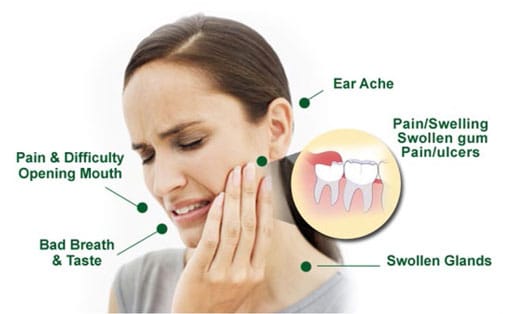 Tooth Extractions | Havelock | Dr. Vipin Grover